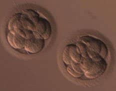 Slider image (8) inSer - Human IVF and Fertility Center